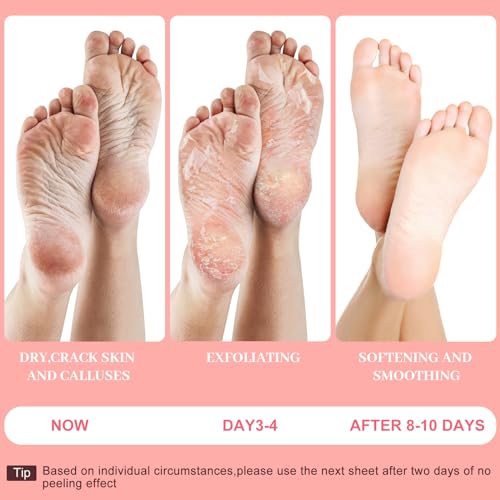Foot Peeling Mask - Pro Callus Remover with Peach Extract for Rough Cracked Dry Feet - Dead Skin Remove, 3Pairs