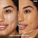 Best Makeup to Hide Spider Veins on Face: Complete Coverage Guide 6 Too Faced Born This Way Super Coverage Multi-Use Concealer | Full Coverage, Non-Comedogenic, Oil Free + Long Lasting Concealer | Hyaluronic Acid, Coconut Water + Alpine Rose | 0.45 Fl Oz, Warm Beige
