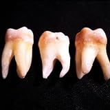 LES DENTS QUI TOMBENT