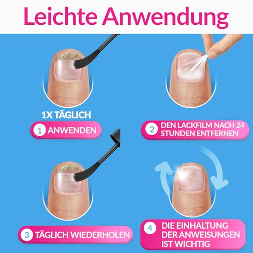 EXCILOR Intensiv - gegen Nagelpilz - Hochwirksame Formel gegen hartnäckigen Nagelpilz - 1 Anwendung pro Tag - 30ml