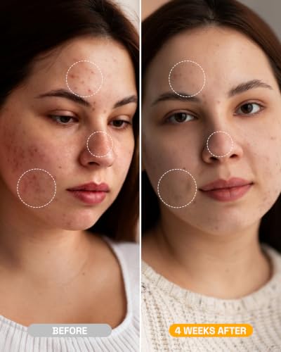 Red Light Therapy Mask for Face - image 2