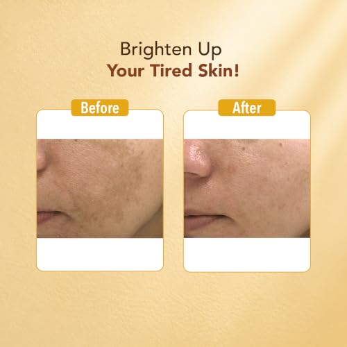 Image of DR.RASHEL Beauty Elixirs Ubtan Face Pack with Haldi for Face & Body Glowing Skin, Oil Control, Acne, Pimples, Blemishes, Pigmentation & Brightening 380 ml