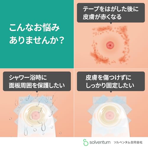 スリーエム（3M）『やさしくはがせるシリコーンテープ』
