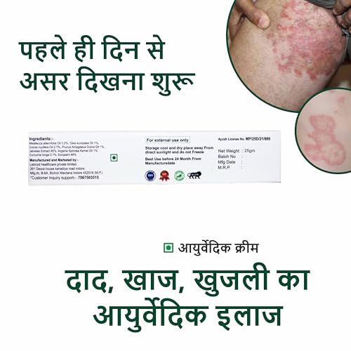 Image of Cream Ayurvedic Treatment for Ringworm, Anti Itching, & Anti Fungal Infections (25 (Gram) Pack of 2, 50, gram)