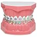 Dental Typodonts Teeth Model Orthodontics Demonstration with Metal Wires Clear Braces Teaching Learning Model for Dental School Students Clinical Education Tool