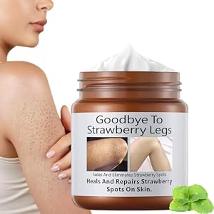 S-trawberry S-kin Treatment,Strawberry Legs Treatment,Keratosis Pilaris Cream，Keratinization & Exfoliating Body Cream for Bumpy Skin, Chicken Skin & Strawberry Spots Repair120g
