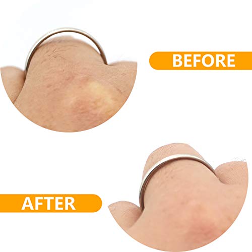 Regolatore della dimensione dell'anello,YMWALK