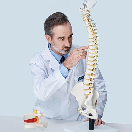 Modèle de hernie discale lombaire pour simplifier les cours d'anatomie complexes