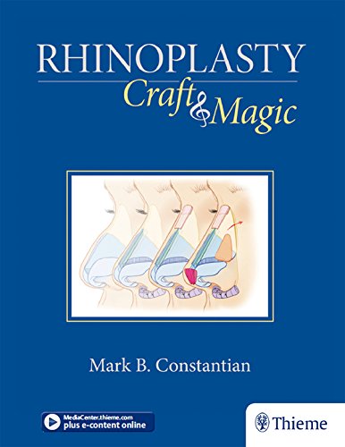 Rhinoplasty: Craft and Magic Rhinoplasty: Craft and Magic