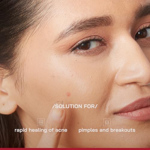 Image of /PHD / Salicylic Acid Acne Spot Treatment Gel 10g | Fast-Acting Pimple Remover & Acne Spot Corrector | Clear Gel with Peptazin Complex | Alternative to Pimple Patches | Salicylic Acid Gel for Face | Targets Breakouts & Reduces Spots Instantly