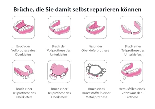 CLICADENT REPAIR: Zahnersatz Reparatur set für zerbrochene Gebisse:patentiertes, von einem Zahnarzt entwickeltes Verfahren für gebrochenen Zahnersatz-FÜR 3 REPARATUREN