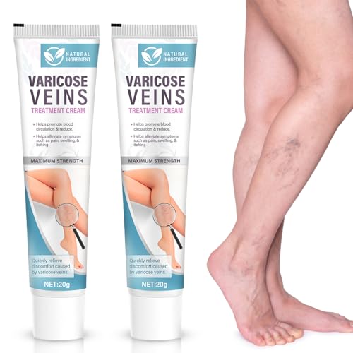 Varicose Veins Treatment for Legs