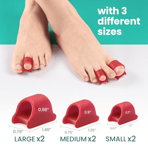 Image of Welnove Hammertoe Corrector - 6 Pack Toe Splints - Soft Gel Toe Straighteners - Realign Bent, Curled, Crooked, Claw, Hammer Toes - Toe Corrector for Men and Women, 3 Different Sizes (Red)