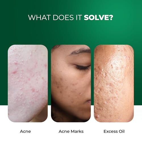 Image of Aqueria Oil Free Gel Based French Face Moisturizer & Oil Control French Face Wash for Oily, Combination & Acne Prone Skin | With Niacinamide, BHA & Multi Actives | Non-Drying, Non Comedogenic, pH Balanced | Safe for Daily Use (Pack of 4 - 50g + 50g Face Moisturizer & 20ml + 20ml Face Wash)