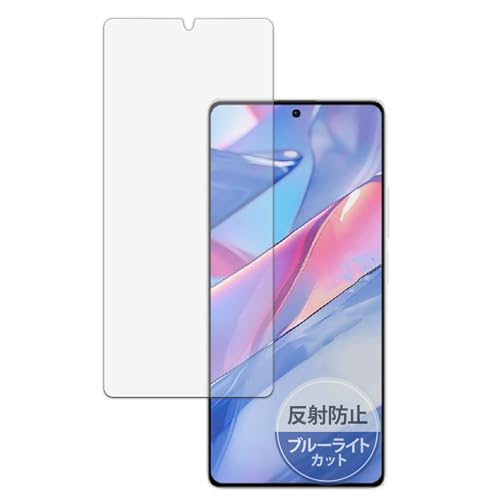 Kayo&Karin Xiaomi Redmi Note 13 5G p یtB u[CgJbg tB ˒ጸ {