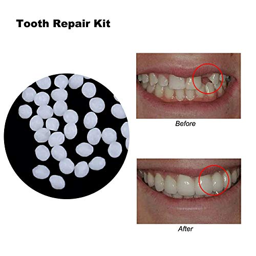 CXQZLH Pegamento sólido de Dientes Falsos, Kit de reparación Temporal de Dientes cosméticos para Dientes de Resina y Huecos Pegamento para dentaduras Creativas,20ml20g