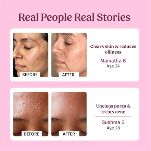 Image of Vilvah Rose Water Facial Toner | Pure Steam Distilled Rose Water to Refine Pores & Balance Skin pH | Alcohol-Free, Hydrating & Soothing Toner for Face | Controls Excess Oil & Calms Irritated Skin | For All Skin Types | 100ml
