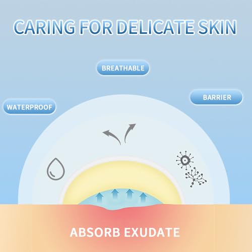 Save 38% on Star Acne Patches - 200 hydrocolloid stickers - Image 3