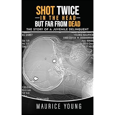 Shot Twice In The Head But Far From Dead: The Story of a Juvenile Delinquent
