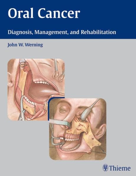 Buy Oral Cancer: Diagnosis, Management and Rehabilitation — BookShops.in