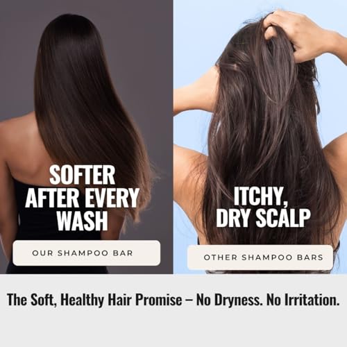 Image of Goli Soda All Natural Probiotics Shampoo Bar for Dry Hair - A Mild Everyday Shampoo for Frizzy and Dry Hair with Natural & Sulphate-Free Ingredients for Deep Moisturization(Pack of 3).