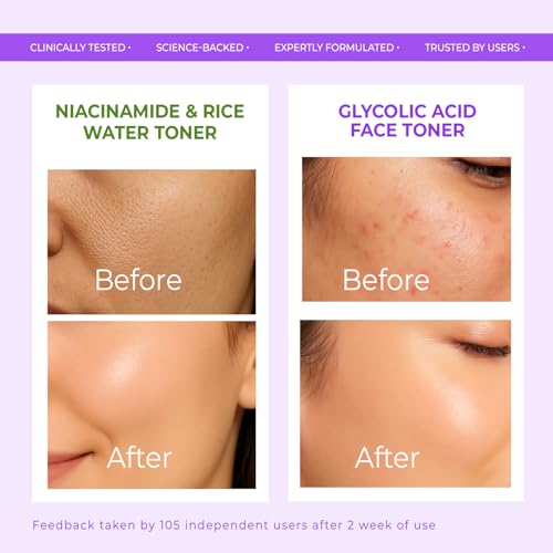 Image of VINR 10% Niacinamide & 1% Hylauronic Acid Rice Water Face Toner Pore Tightening & Glowing Skin Oil Control | Hydrating Facial Toner for Acne-Prone, Sensitive & All Skin Types | Women & Men -200ml (Pack of 2 )