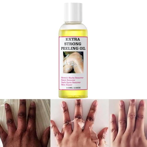 Generic Extra Strong Yellow Peeling Oil for Dark Skin - Exfoliating Solution for Body Hand Feet and Face - All Skin Types (110ML/3.88 Fl Oz)