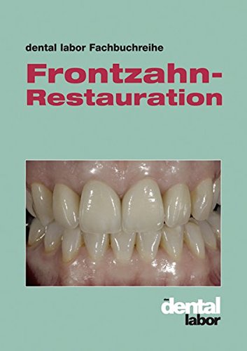 Preisvergleich Produktbild Frontzahn-Restauration: dental labor-Fachbuchreihe