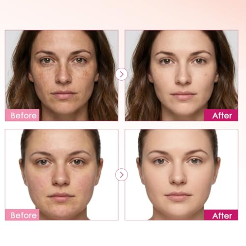 XILRVON Arbutin 7% + Tranexamic Acid 4% Cream with Niacinamide 1% for Dark Spots & Pigmentation Concerns, Uneven Skin Tone – Moisturizing, Non-Irritating Skin Barrier Care for Sensitive Skin, 1.76 oz