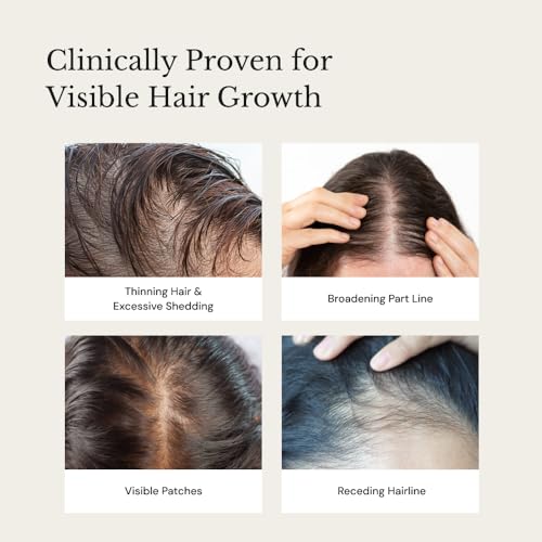 Image of Richfeel Anagrow Advanced Hair Regrowth Serum - A Swiss Formula • Controls Hair Fall • Stimulates Regrowth • Boosts Density • Lightweight Formula (2x15ml)