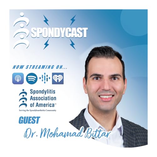 When Pain Persists: Understanding the Brain&rsquo;s Role in Spondyloarthritis