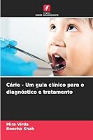 Cárie - Um guia clínico para o diagnóstico e tratamento 6208650895 Book Cover