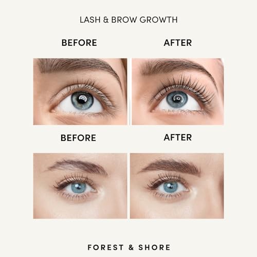 Forest & Shore Castor Oil 100% Natural & Organic for Hair Growth Eyebrows, Eyelashes and Skin Hair Tonic Oil - Image 3