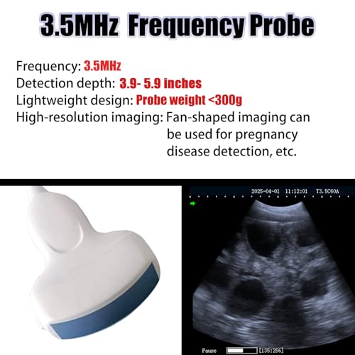 ultrasound machine pro 1669