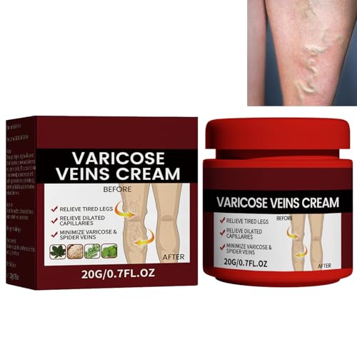 KOAHDE Cream for Varicose Veins in Legs,Varicose Veins Cream,Vein Relief Cream,Vein Cream for Legs,Varicose Veins Treatment Cream,Varicose Vein Removal Cream,Improve Blood Circulation,20G,1PC