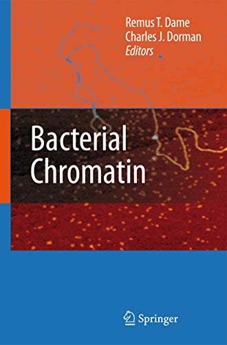 Bacterial Chromatin view 2
