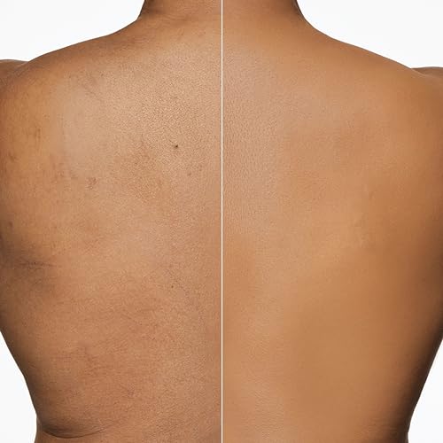 Image of Dermablend Leg & Body Makeup Foundation SPF 25, 45W, 3.4 fl oz