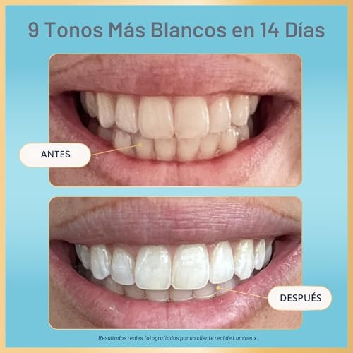 Lumineux Teeth Whitening Strips Kit — detail view