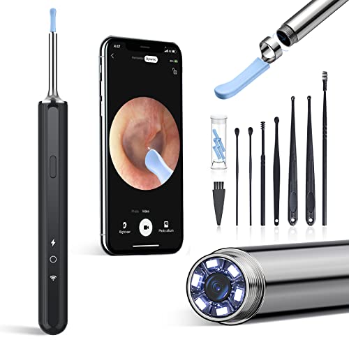 New Ear Wax Removal Cameras Help You Keep Your Ears Healthy And Clean