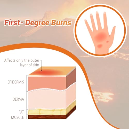 Image of Burn Wound Packing Trainer, Burn Moulage, Adhesive Skin Burn Wound Trainer for Wound Care Training, First Degree Burn Wound Training Model