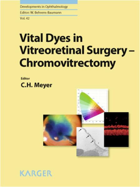 Vital Dyes in Vitreoretinal Surgery: Chromovitrectomy (Developments in Ophthalmology)