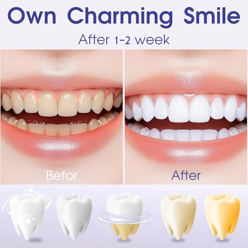 Image of Teeth Whitening Pen, Effective, Travel-Friendly, and Easy to Use Gel Whitening Pen, Teeth Whitener - Low Sensitivity (Pack of 2)