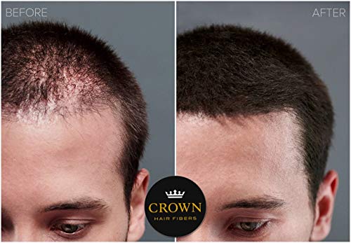 CROWN HAIR FIBERS for Thinning Hair (BLACK) - Instantly Thickens Thinning or Balding Hair for Men & Women - 2x Large 0.87oz/25g Bottle - Best Natural Keratin Hair Loss Concealer