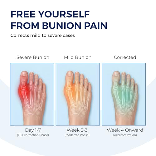 Image of Bunion Corrector for Women and Men Adjustable Toe Straightener Support
