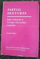 Partial Dentures 0632002514 Book Cover