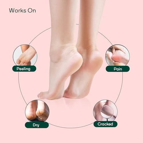Image of IZZORI Silicone Gel Heel Socks for Dry Hard Cracked Heel Repair Pad, Heel Swelling & Pain Relief, Plantar Fasciitis (Free Size, Pink, 1 Pair)