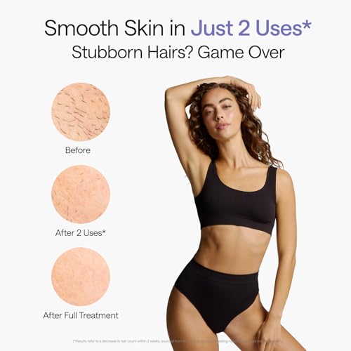 Ulike Laser Hair Removal Device Air 10 Ipl Gift for Women and Men, Ice Cool and Permanent Hair Reduction for Nearly Painless, Dual Lights, Skin Sensor & USHR Mode Hair Removal in 10mins from Home - Image 5