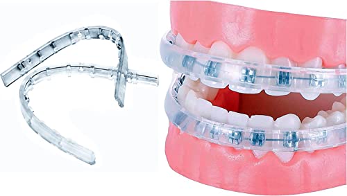 Comfort Cover for Braces Lip Protector Mouth Guard Lip Cushion Teeth Shield Bumper for Brackets Aligner Dental Wax Alternative Hard and Rigid Clip