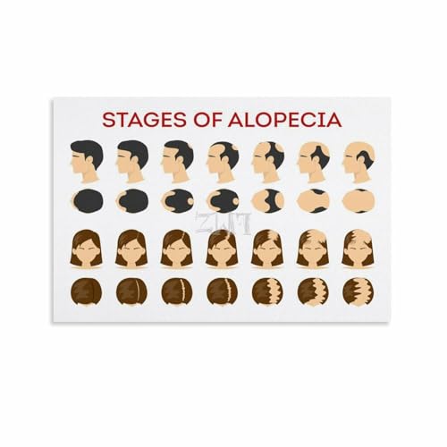 Hair Loss Stages Chart Poster - Wall Decor 18x12in