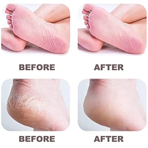 Image of Electric Foot File - Callus Remover for Feet, Professional Pedicure Tool for Dead Skin and Calluses with 2 Different Roller Heads